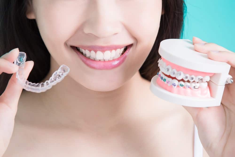 6 Alternatives to Braces for a Great Smile - ThreadCurve