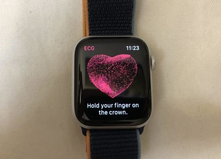 Best Overall Smartwatch (for iPhone and Android users)