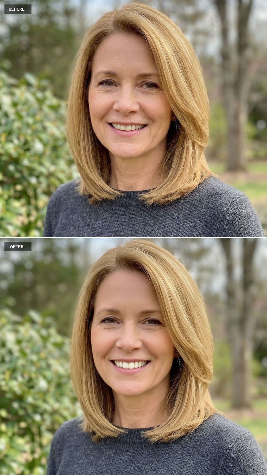 Teeth Whitening - Natural Bright