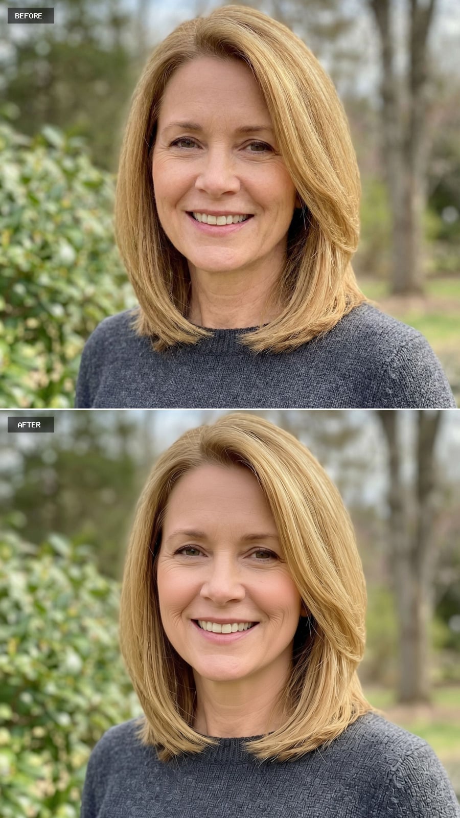 Cheek Enhancement - Subtle Contour