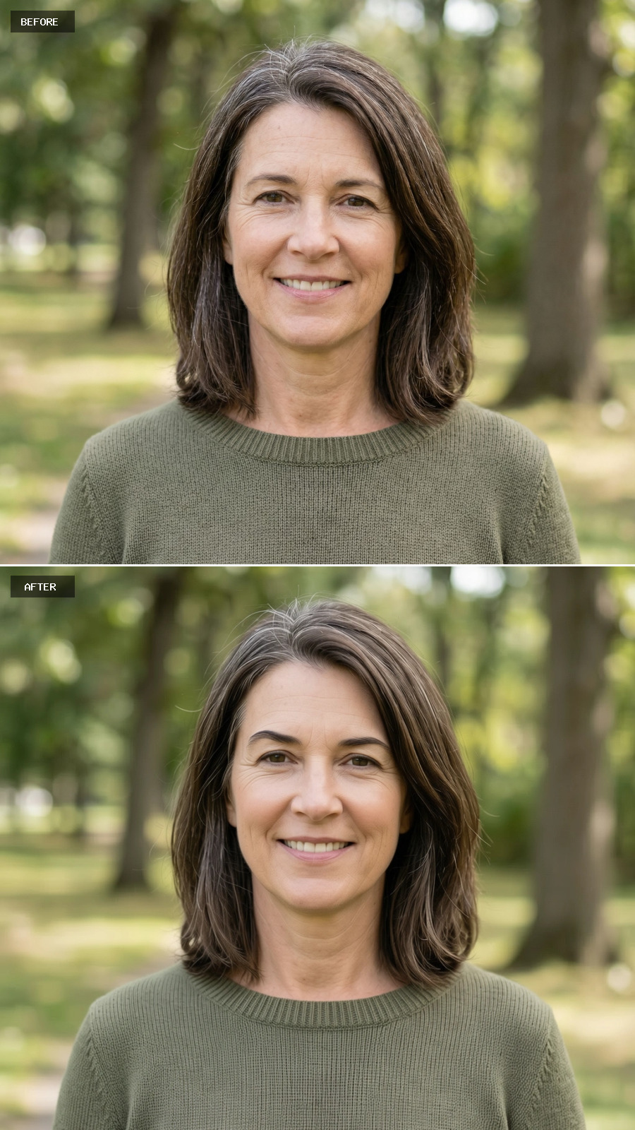 Brow Lift - Subtle Elevation