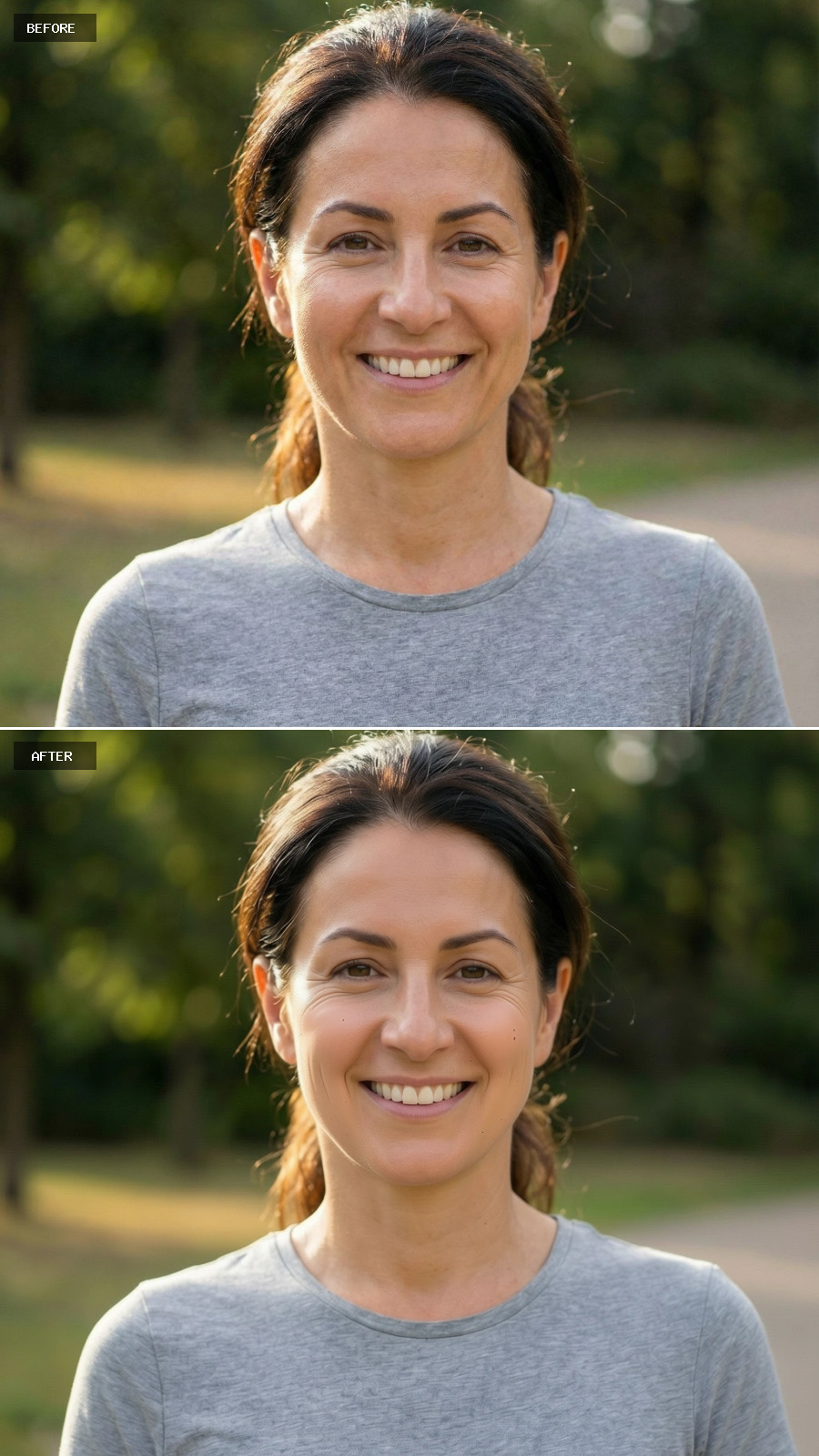 Cheek Enhancement - Subtle Contour